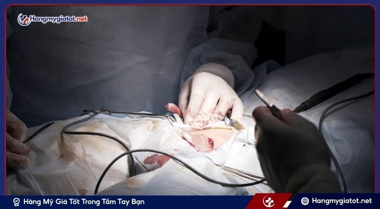 Các Phương Pháp Can Thiệp Y Khoa