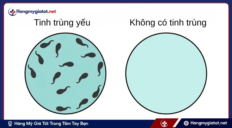 Hiểu đúng về tình trạng “không có tinh trùng” và “tinh trùng yếu”
