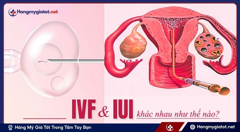 So sánh các phương pháp hỗ trợ sinh sản IUI, IVF, ICSI